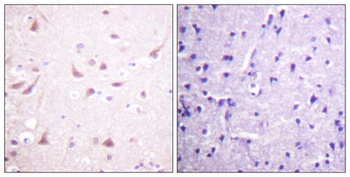 CRMP-2 rabbit pAb Antibody