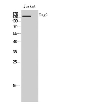 Dsg2 rabbit pAb Antibody