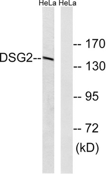 Dsg2 rabbit pAb Antibody