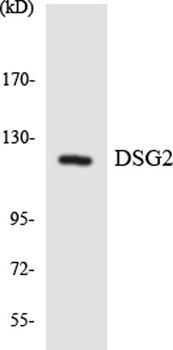 Dsg2 rabbit pAb Antibody