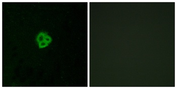 AT1 rabbit pAb Antibody