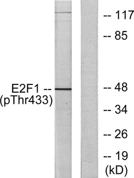 E2F-1 (phospho Thr433) rabbit pAb Antibody