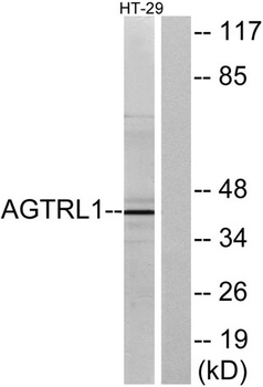 APLNR rabbit pAb Antibody