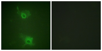 EDG-1 (phospho Thr236) rabbit pAb Antibody