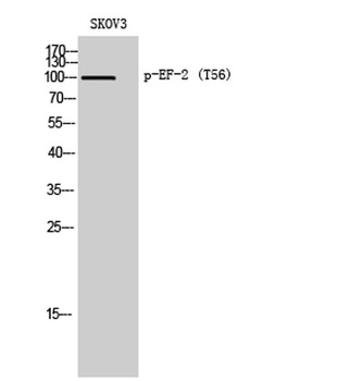 EF-2 (phospho Thr56) rabbit pAb Antibody