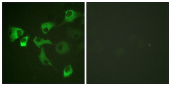 EF-2 (phospho Thr56) rabbit pAb Antibody