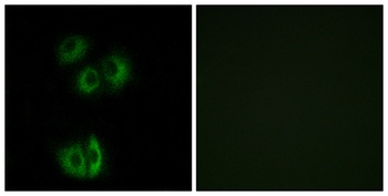 CELSR3 rabbit pAb Antibody