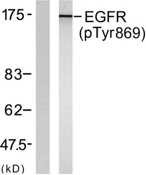 EGFR (phospho Tyr869) rabbit pAb Antibody