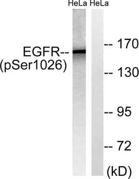 EGFR (phospho Ser1026) rabbit pAb Antibody