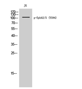 EphA2/5 (phospho Tyr594) rabbit pAb Antibody