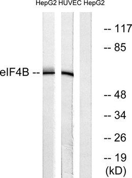 eIF4B rabbit pAb Antibody
