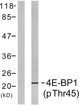4E-BP1 (phospho Thr46) rabbit pAb Antibody