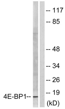 4E-BP1 rabbit pAb Antibody