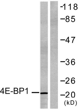 4E-BP1 rabbit pAb Antibody