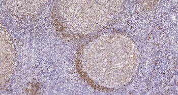 eIF5 rabbit pAb Antibody