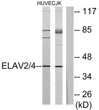 HuB/D rabbit pAb Antibody