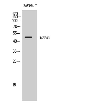 IGSF4C rabbit pAb Antibody