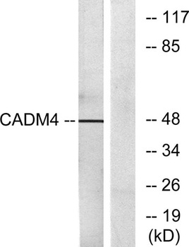 IGSF4C rabbit pAb Antibody