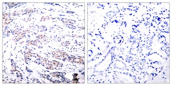 Elk-1 rabbit pAb Antibody