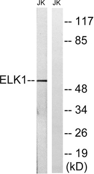 Elk-1 rabbit pAb Antibody