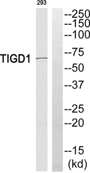 TIGD1 rabbit pAb Antibody