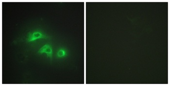 AK1 rabbit pAb Antibody