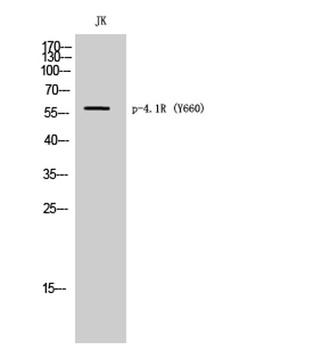 4.1R (phospho Tyr660) rabbit pAb Antibody