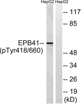4.1R (phospho Tyr660) rabbit pAb Antibody