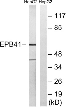 4.1R rabbit pAb Antibody