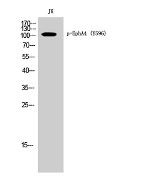 EphA4 (phospho Tyr596) rabbit pAb Antibody