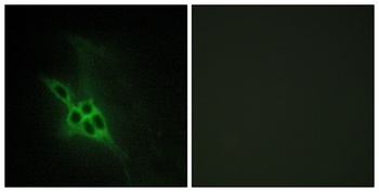 EphB1/2/3 rabbit pAb Antibody
