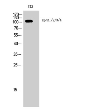 EphB1/2/3/4 rabbit pAb Antibody