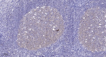 EphB1/2/3/4 rabbit pAb Antibody