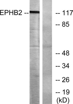 EphB2 rabbit pAb Antibody