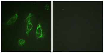 EpoR rabbit pAb Antibody
