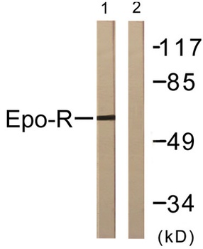 EpoR rabbit pAb Antibody