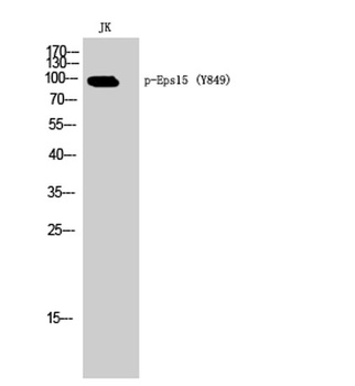 Eps15 (phospho Tyr849) rabbit pAb Antibody