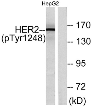 Neu (phospho Tyr1248) rabbit pAb Antibody
