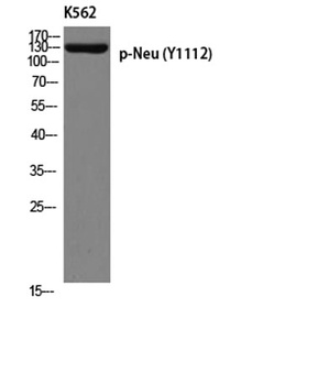 Neu (phospho Tyr1112) rabbit pAb Antibody