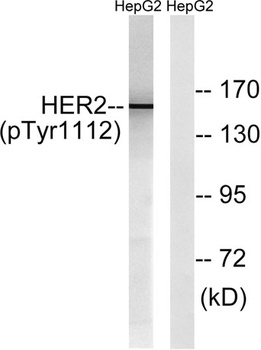 Neu (phospho Tyr1112) rabbit pAb Antibody