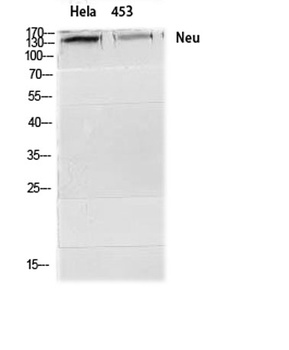 Neu rabbit pAb Antibody