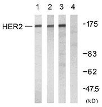 Neu rabbit pAb Antibody