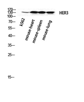 ErbB-3 rabbit pAb Antibody