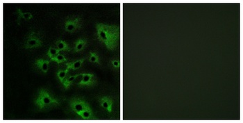 ErbB-4 (phospho Tyr1284) rabbit pAb Antibody