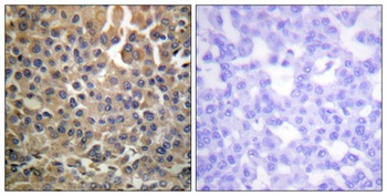 ErbB-4 (phospho Tyr1284) rabbit pAb Antibody
