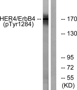 ErbB-4 (phospho Tyr1284) rabbit pAb Antibody