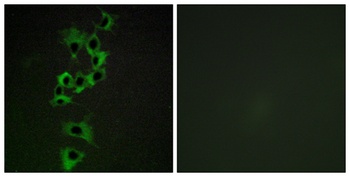 ErbB-4 rabbit pAb Antibody