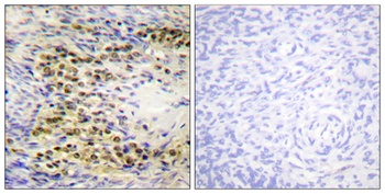Akt1 (phospho Thr72) rabbit pAb Antibody