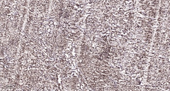 CSB rabbit pAb Antibody