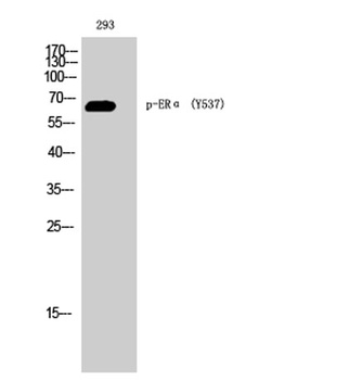 ERα (phospho Tyr537) rabbit pAb Antibody